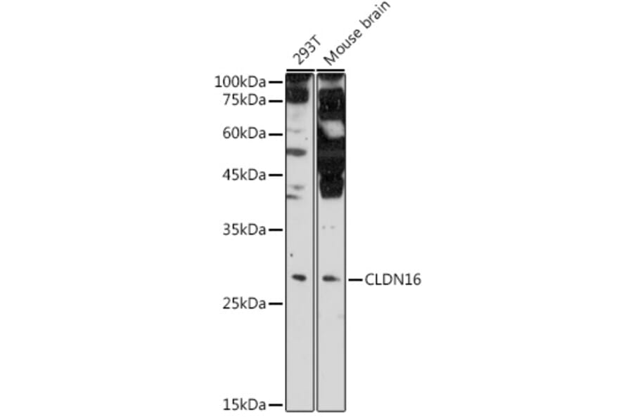 Western Blot - Anti-CLDN16/Claudin-16 Antibody (A10818) - Antibodies.com