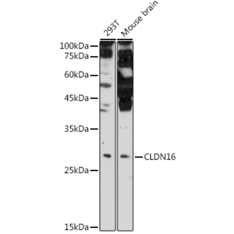 Western Blot - Anti-CLDN16/Claudin-16 Antibody (A10818) - Antibodies.com