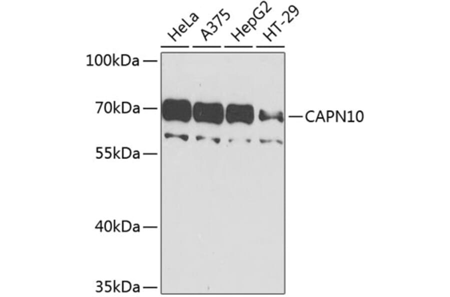 Western Blot - Anti-Calpain 10 Antibody (A10819) - Antibodies.com