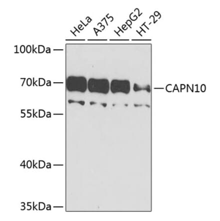 Western Blot - Anti-Calpain 10 Antibody (A10819) - Antibodies.com