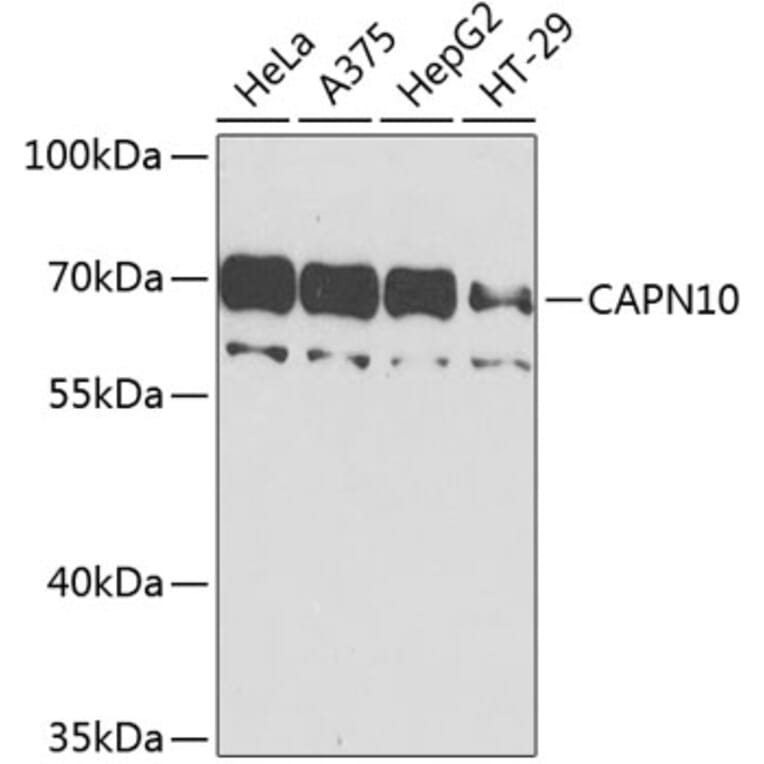 Western Blot - Anti-Calpain 10 Antibody (A10819) - Antibodies.com