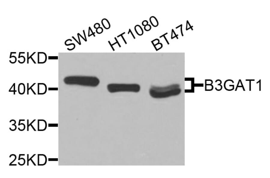 Western Blot - Anti-B3GAT1 Antibody (A9871) - Antibodies.com