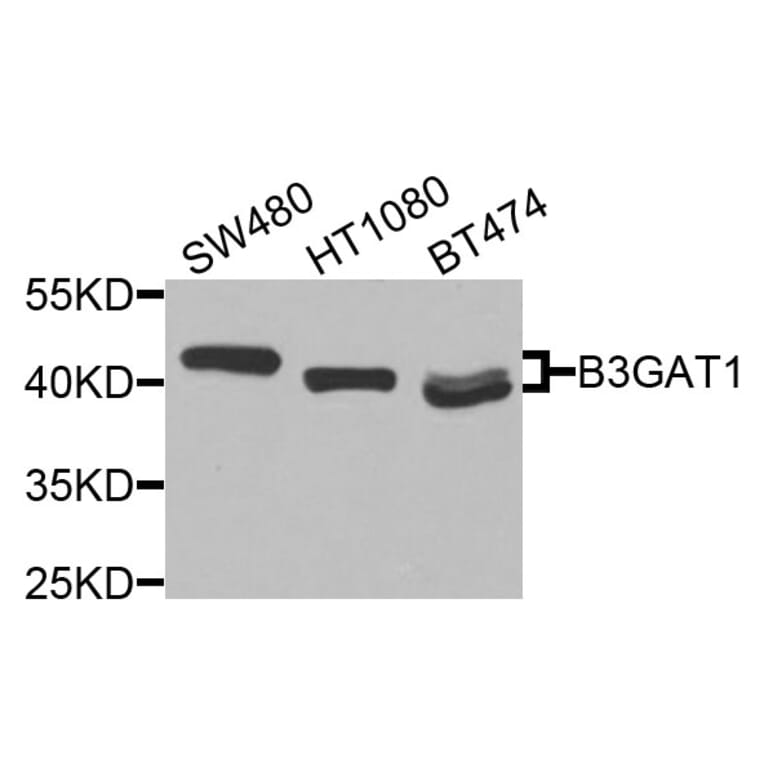 Western Blot - Anti-B3GAT1 Antibody (A9871) - Antibodies.com