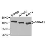 Western Blot - Anti-B3GAT1 Antibody (A9871) - Antibodies.com