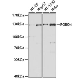 Western Blot - Anti-Robo4 Antibody (A10823) - Antibodies.com