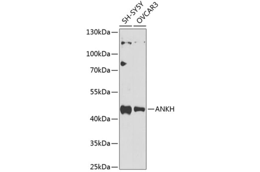 Western Blot - Anti-ANKH Antibody (A10824) - Antibodies.com