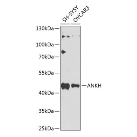 Western Blot - Anti-ANKH Antibody (A10824) - Antibodies.com