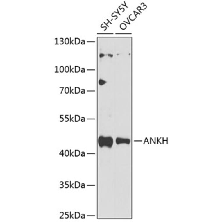Western Blot - Anti-ANKH Antibody (A10824) - Antibodies.com