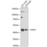 Western Blot - Anti-ANKH Antibody (A10824) - Antibodies.com