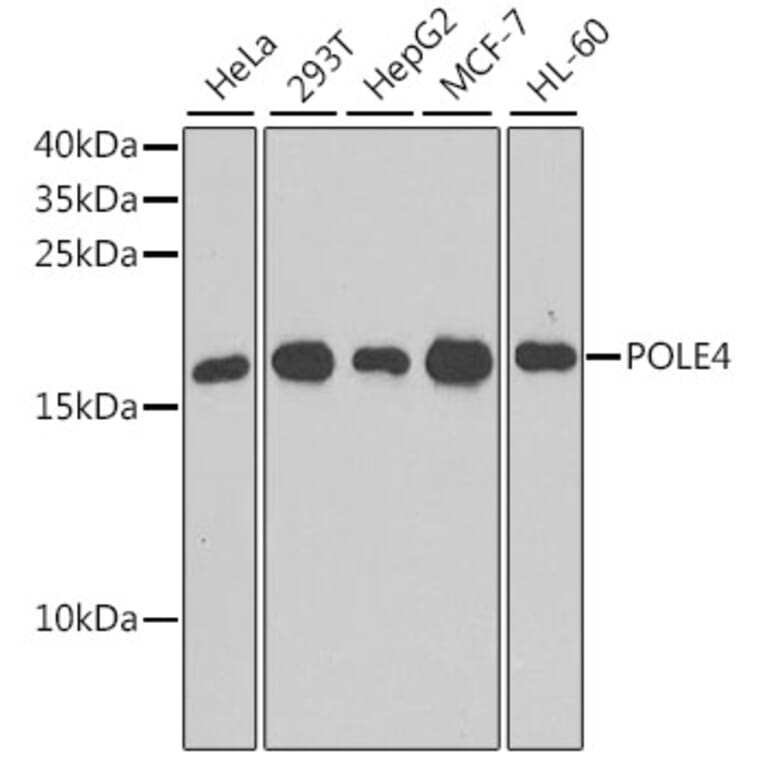 Western Blot - Anti-POLE4 Antibody (A10825) - Antibodies.com