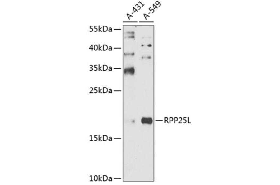 Western Blot - Anti-RPP25L Antibody (A10826) - Antibodies.com