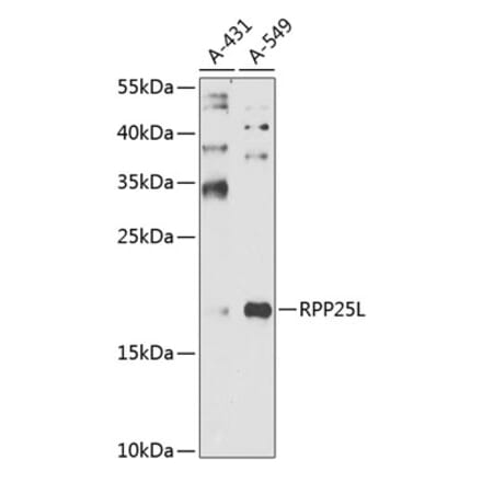 Western Blot - Anti-RPP25L Antibody (A10826) - Antibodies.com