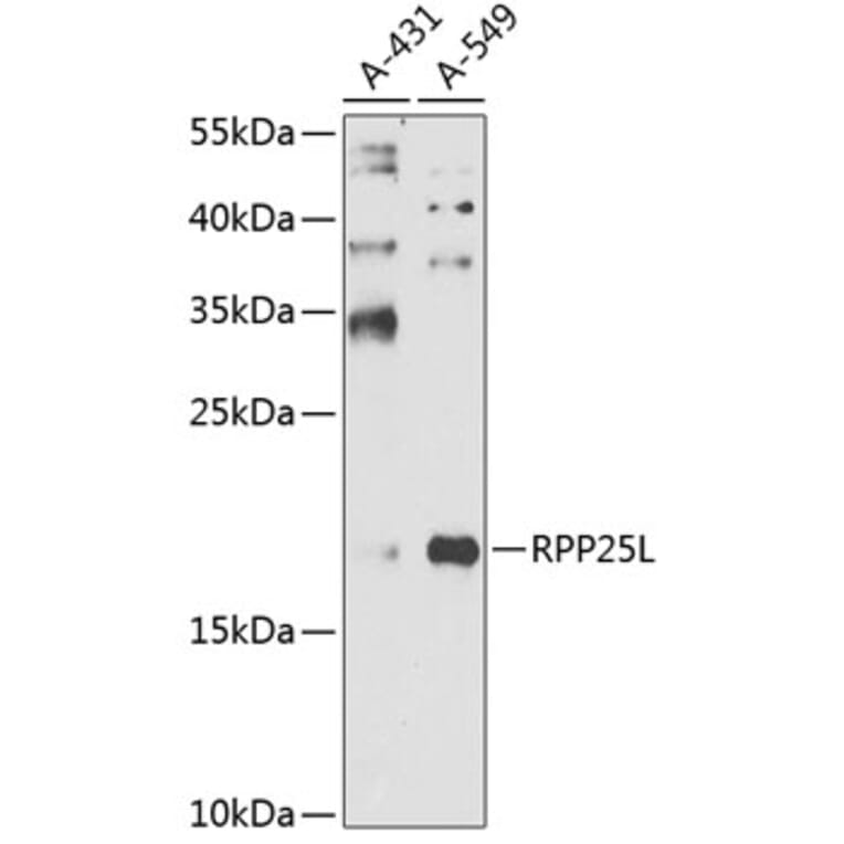 Western Blot - Anti-RPP25L Antibody (A10826) - Antibodies.com