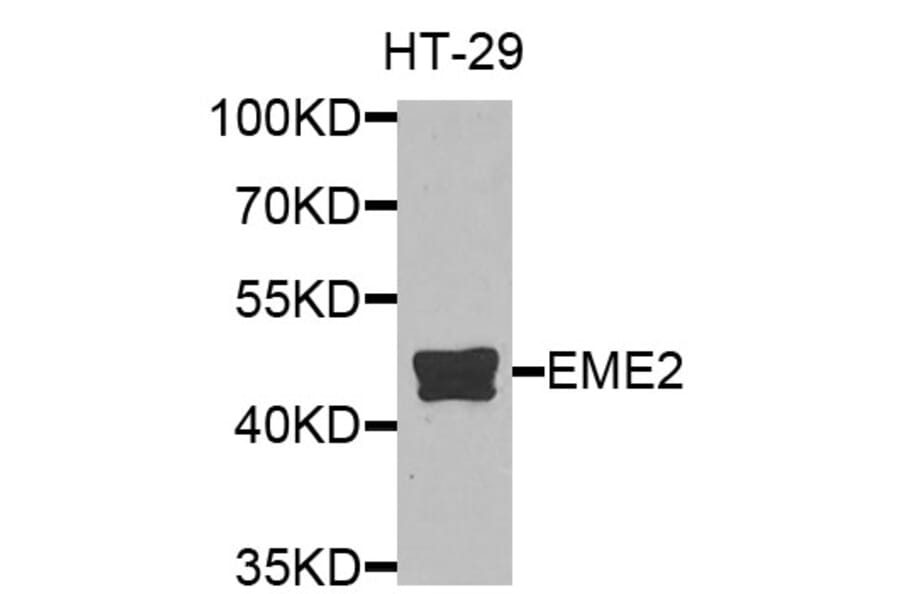 Western Blot - Anti-EME2 Antibody (A9891) - Antibodies.com