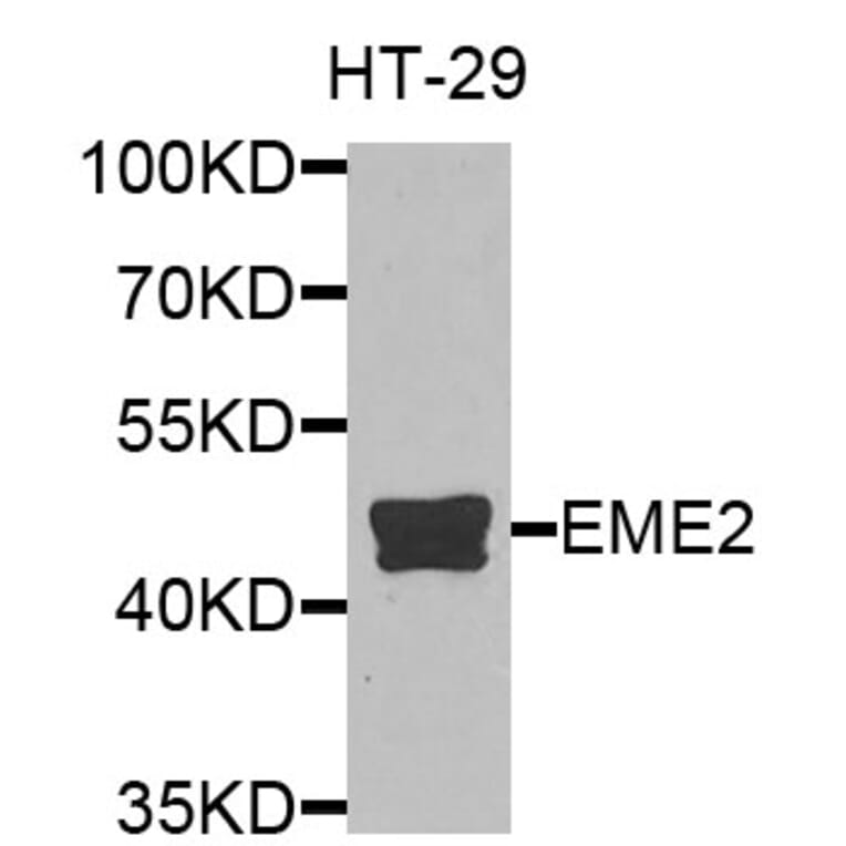 Western Blot - Anti-EME2 Antibody (A9891) - Antibodies.com
