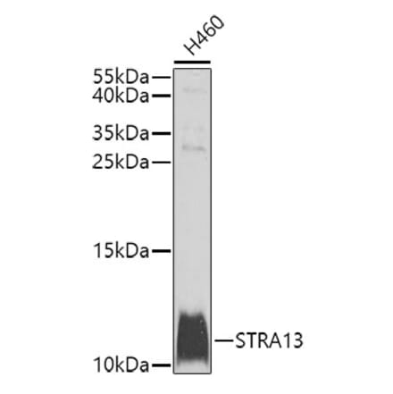 Western Blot - Anti-MHF2 Antibody (A10828) - Antibodies.com