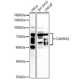 Western Blot - Anti-CAMKK2 Antibody (A10829) - Antibodies.com