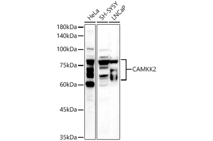 Western Blot - Anti-CAMKK2 Antibody (A10829) - Antibodies.com