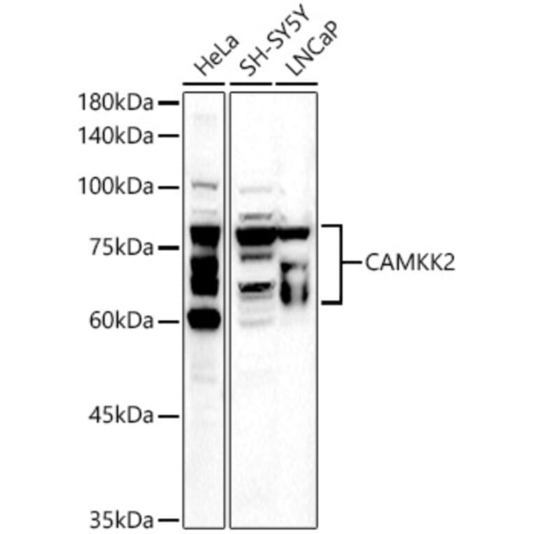 Western Blot - Anti-CAMKK2 Antibody (A10829) - Antibodies.com