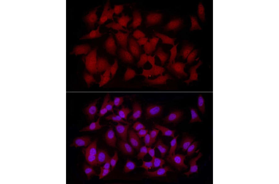 Immunofluorescence - Anti-CAMKK2 Antibody (A10829) - Antibodies.com