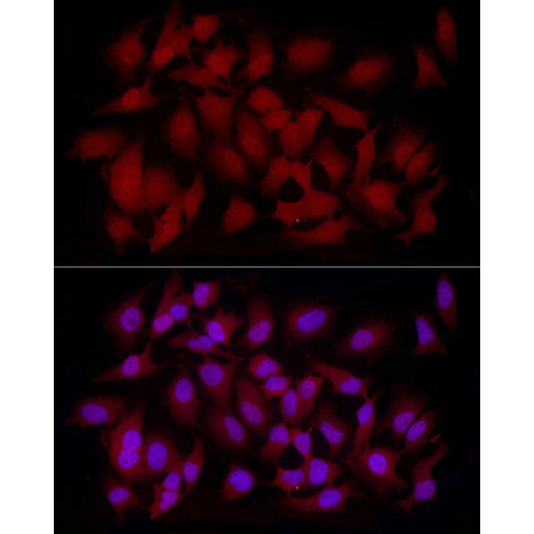 Immunofluorescence - Anti-CAMKK2 Antibody (A10829) - Antibodies.com