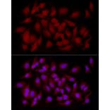 Immunofluorescence - Anti-CAMKK2 Antibody (A10829) - Antibodies.com