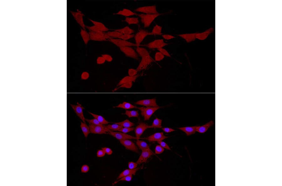 Immunofluorescence - Anti-CAMKK2 Antibody (A10829) - Antibodies.com
