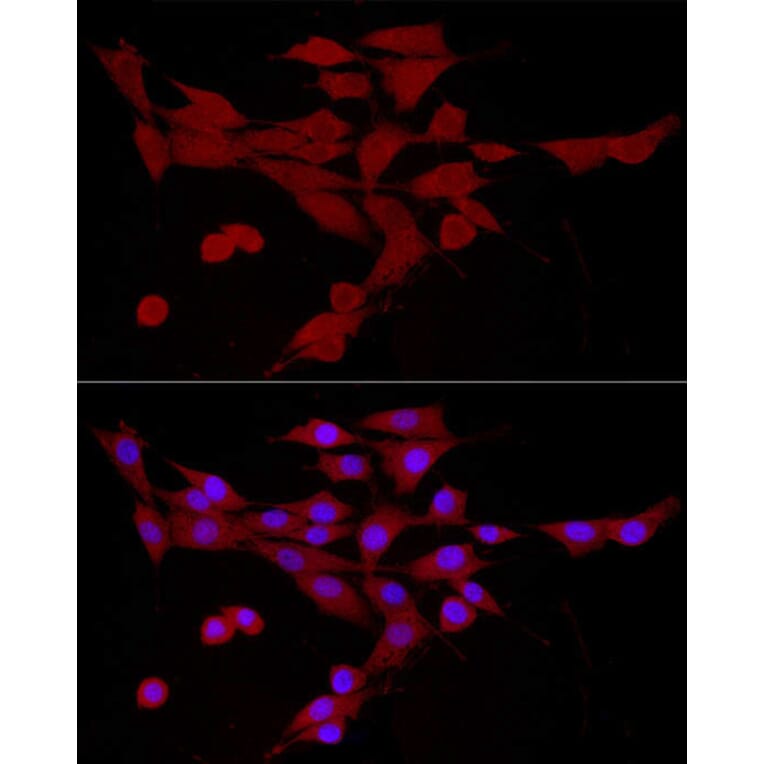 Immunofluorescence - Anti-CAMKK2 Antibody (A10829) - Antibodies.com