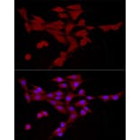 Immunofluorescence - Anti-CAMKK2 Antibody (A10829) - Antibodies.com