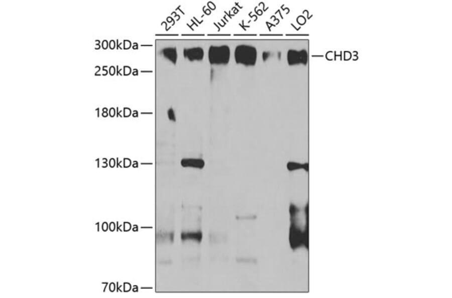 Western Blot - Anti-CHD3 Antibody (A9903) - Antibodies.com