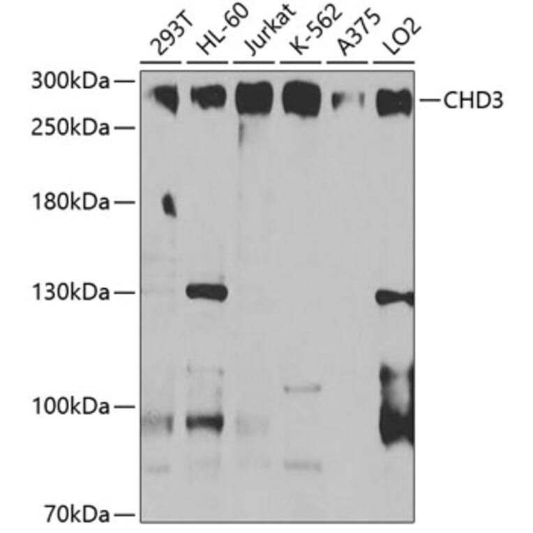 Western Blot - Anti-CHD3 Antibody (A9903) - Antibodies.com