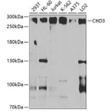 Western Blot - Anti-CHD3 Antibody (A9903) - Antibodies.com