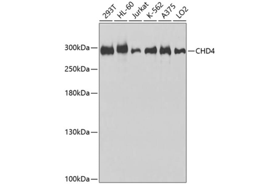 Western Blot - Anti-CHD4 Antibody (A9904) - Antibodies.com