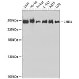 Western Blot - Anti-CHD4 Antibody (A9904) - Antibodies.com