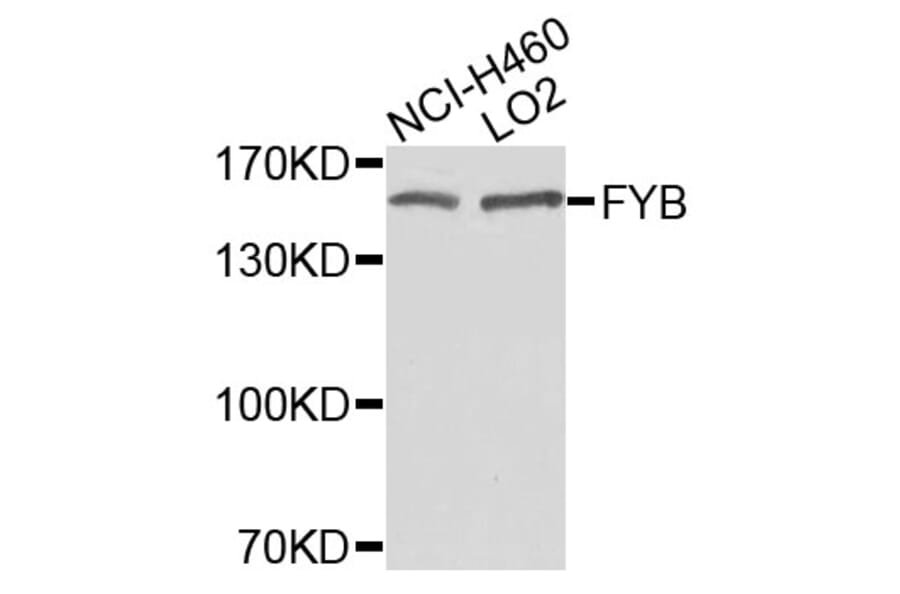 Western Blot - Anti-FYB Antibody (A9906) - Antibodies.com