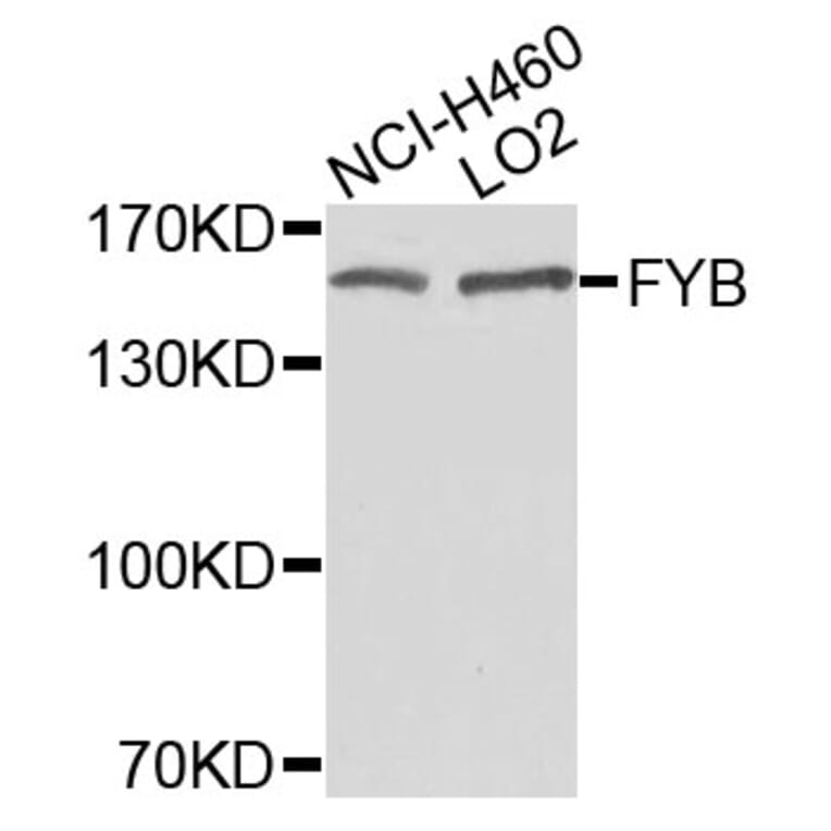 Western Blot - Anti-FYB Antibody (A9906) - Antibodies.com