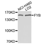 Western Blot - Anti-FYB Antibody (A9906) - Antibodies.com