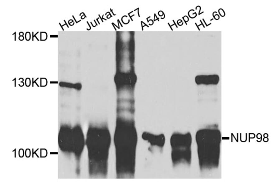 Western Blot - Anti-NUP98 Antibody (A9908) - Antibodies.com