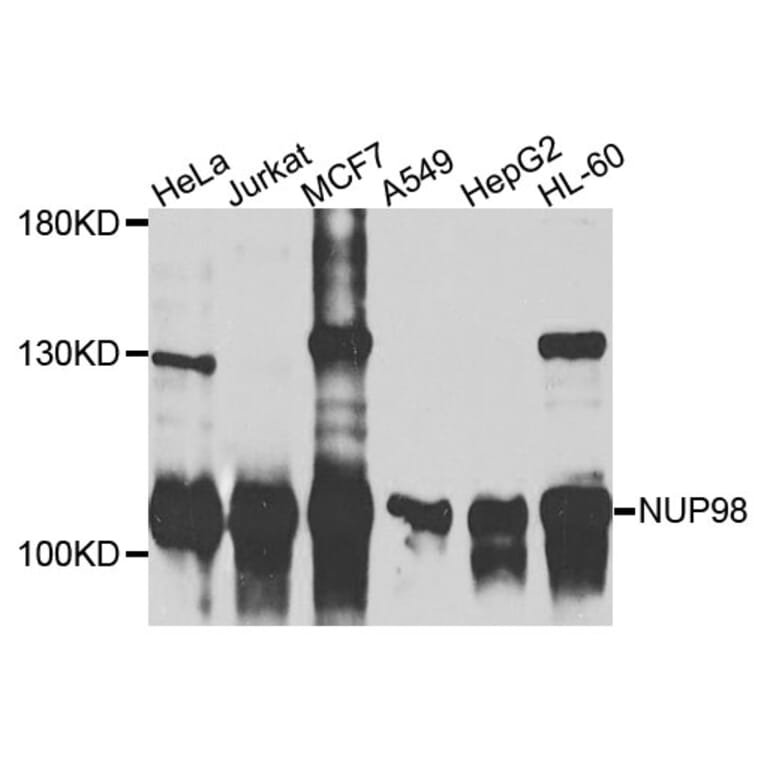 Western Blot - Anti-NUP98 Antibody (A9908) - Antibodies.com