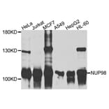 Western Blot - Anti-NUP98 Antibody (A9908) - Antibodies.com