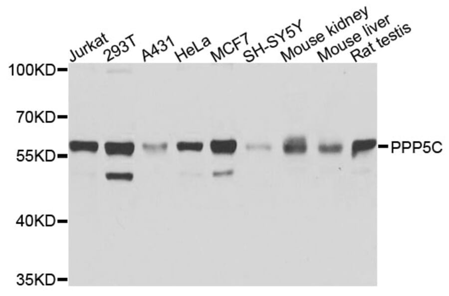 Western Blot - Anti-PPP5C Antibody (A9910) - Antibodies.com
