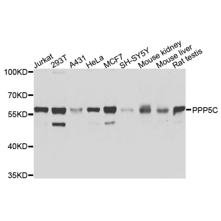 Western Blot - Anti-PPP5C Antibody (A9910) - Antibodies.com