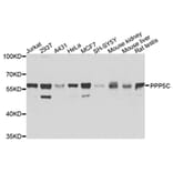Western Blot - Anti-PPP5C Antibody (A9910) - Antibodies.com
