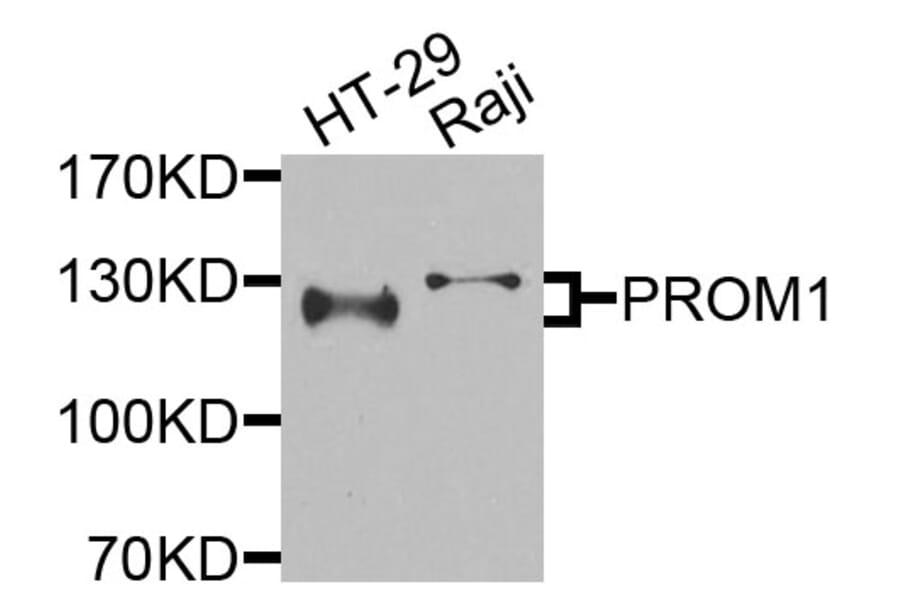 Western Blot - Anti-PROM1 Antibody (A9915) - Antibodies.com