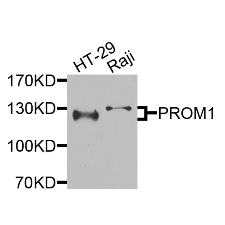 Western Blot - Anti-PROM1 Antibody (A9915) - Antibodies.com