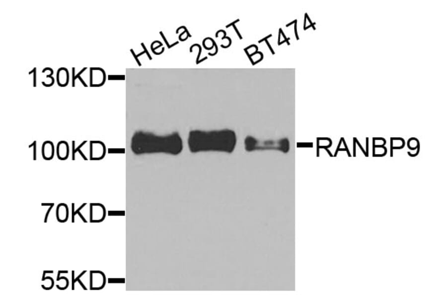Western Blot - Anti-RANBP9 Antibody (A9916) - Antibodies.com