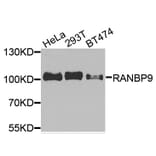 Western Blot - Anti-RANBP9 Antibody (A9916) - Antibodies.com