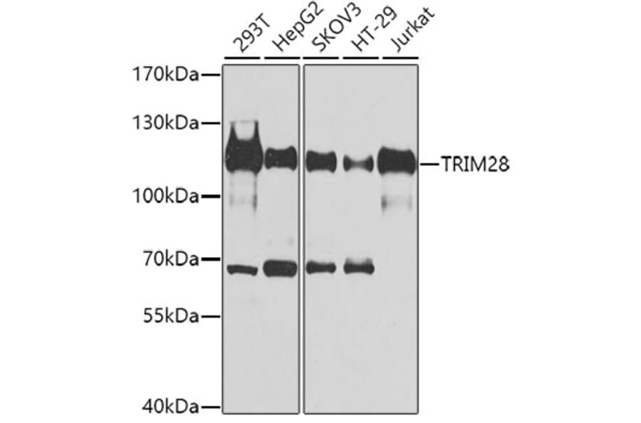 Western Blot - Anti-TRIM28 Antibody (A9917) - Antibodies.com