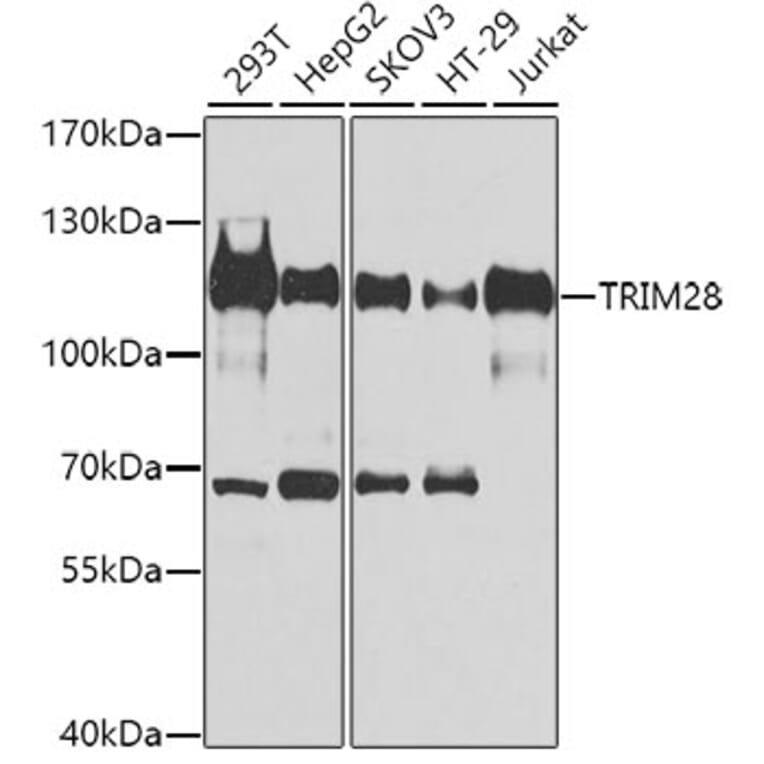 Western Blot - Anti-TRIM28 Antibody (A9917) - Antibodies.com