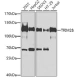 Western Blot - Anti-TRIM28 Antibody (A9917) - Antibodies.com